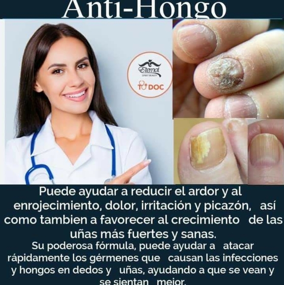 Fungi Freh/ Anti-Fungus EternalSpiritBeauty - Picture 3 of 12